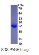 Eukaryotic Interleukin 1 Beta (IL1b)