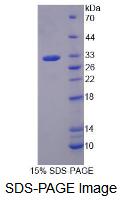 Recombinant G Protein Beta 3 (GNb3)