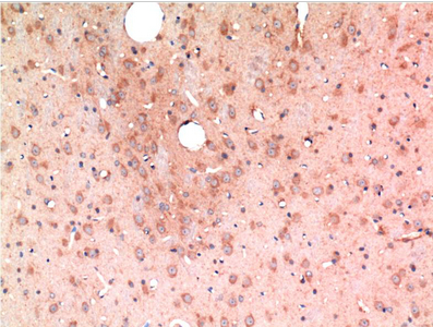 TGFβ1 Mouse Monoclonal Antibody(10E5)