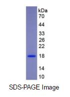 Eukaryotic Cerebral Dopamine Neurotrophic Factor (CDNF)