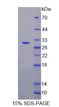 Recombinant Growth Factor Receptor Bound Protein 14 (Grb14)