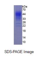 Eukaryotic Interferon Gamma (IFNg)