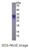 Eukaryotic Retinol Binding Protein 4, Plasma (RBP4)