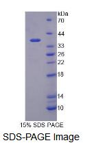 Recombinant Transcriptional Intermediary Factor 1 Beta (TIF1b)