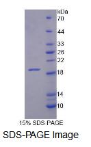 Recombinant Xylosyltransferase I (XYLT1)