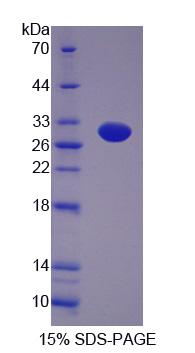 Recombinant G-Elongation Factor, Mitochondrial 2 (GFM2)