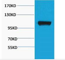 PEPC Polyclonal Antibody