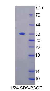 Recombinant Junctophilin 3 (JPH3)