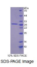 Recombinant Ferredoxin Reductase (FDXR)