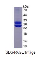 Eukaryotic Prolactin (PRL)