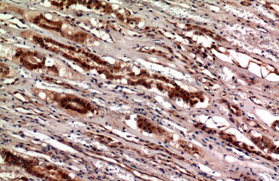 Cystatin C Mouse Monoclonal Antibody(5F1)