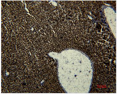 Transferrin Monoclonal Antibody