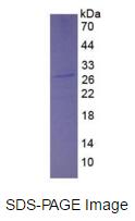 Eukaryotic Growth Factor Receptor Bound Protein 2 (Grb2)