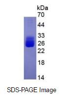 Eukaryotic Interleukin 6 (IL6)