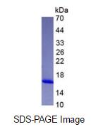 Eukaryotic Fatty Acid Binding Protein 4, Adipocyte (FABP4)