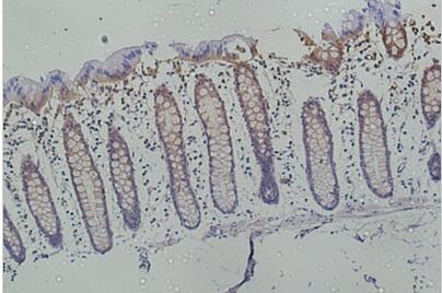 Galectin-3 Monoclonal Antibody