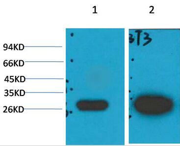 Galectin-3 Monoclonal Antibody