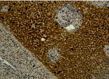 Transferrin Monoclonal Antibody