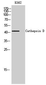 Cathepsin D Polyclonal Antibody