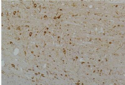 Cav1.3 Polyclonal Antibody