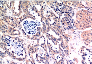 Bax Mouse Monoclonal Antibody(6F11)