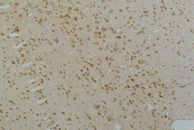 Cav1.2 Polyclonal Antibody