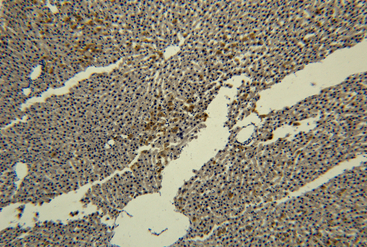 Transferrin Monoclonal Antibody