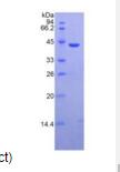 Active Mannose Associated Serine Protease 2 (MASP2)