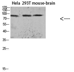 Tau (Acetyl Lys174) Polyclonal Antibody