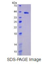 Active Hypoxia Inducible Factor 1 Alpha (HIF1a)