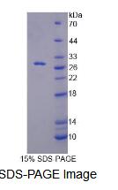 Recombinant Replication Factor C5 (RFC5)