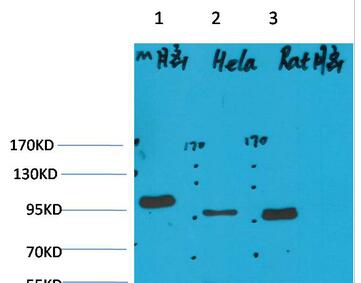 EphA1 Polyclonal Antibody