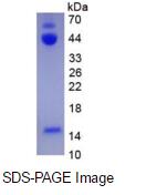 Eukaryotic Inhibin Beta A (INHbA)