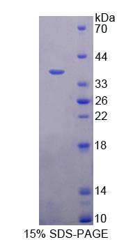 A Disintegrin And Metalloprotease 1 Recombinant Protein