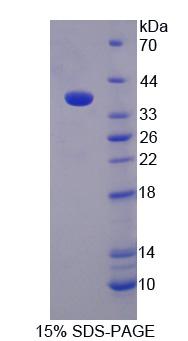 Recombinant Cancer Susceptibility Candidate 1 (CASC1)