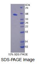 Recombinant Nuclear Receptor Corepressor 1 (NCOR1)