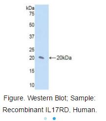 Active Interleukin 17 Receptor D (IL17RD)