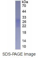 Eukaryotic Fibronectin Type III Domain Containing Protein 5 (FNDC5)