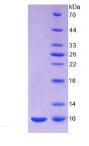 Active Insulin (INS)