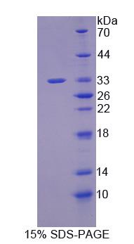 Recombinant Junctophilin 3 (JPH3)