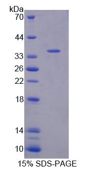 Recombinant Calcyphosine 2 (CAPS2)