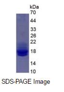 Eukaryotic Interleukin 2 (IL2)