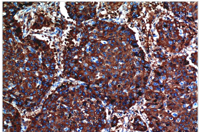 AKT Mouse Monoclonal Antibody(10D6)