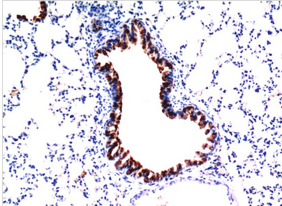 TGFβ1 Mouse Monoclonal Antibody(5D2)