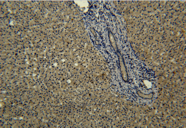 Transferrin Monoclonal Antibody