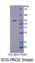 Recombinant Exportin 6 (XPO6)