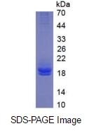 Eukaryotic Interleukin 2 (IL2)