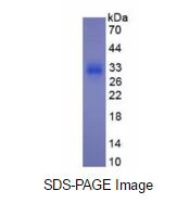 Eukaryotic Procollagen III N-Terminal Propeptide (PIIINP)