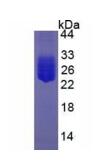 Active Interleukin 6 (IL6)