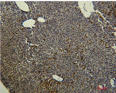 Transferrin Monoclonal Antibody